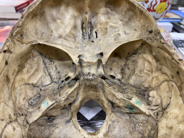 Antique 19th Century Medical Human Skull Teaching Aid - Source Vintage
