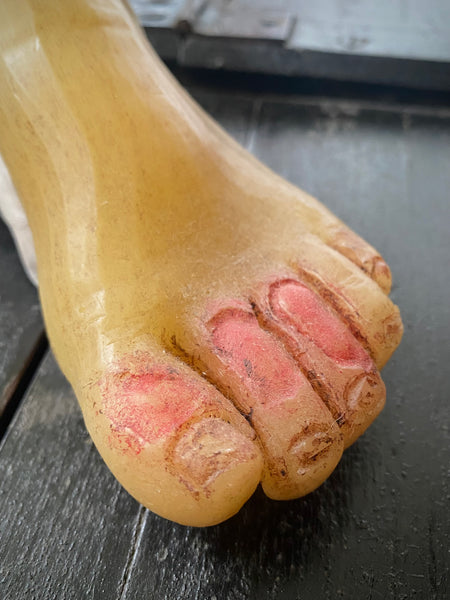 **RESERVED** Rare Antique Wax Medical Moulage Foot Study With Frostbitten Toes c.1900