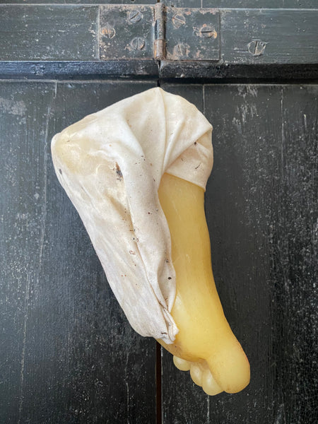 **RESERVED** Rare Antique Wax Medical Moulage Foot Study With Frostbitten Toes c.1900