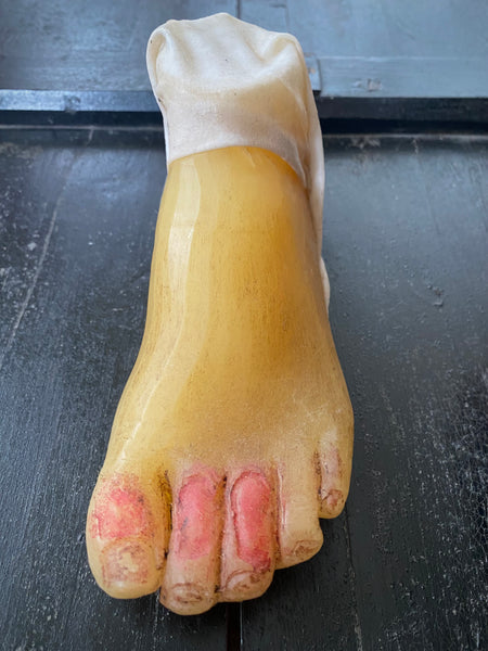 **RESERVED** Rare Antique Wax Medical Moulage Foot Study With Frostbitten Toes c.1900