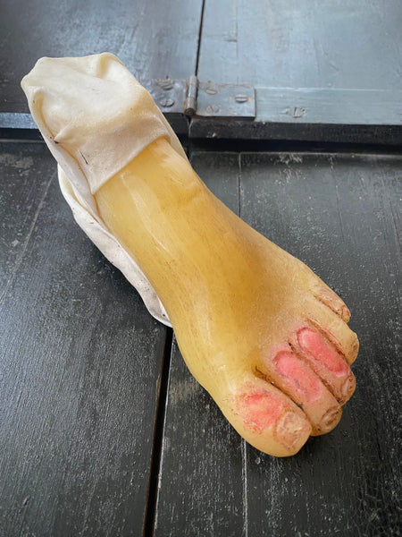 **RESERVED** Rare Antique Wax Medical Moulage Foot Study With Frostbitten Toes c.1900