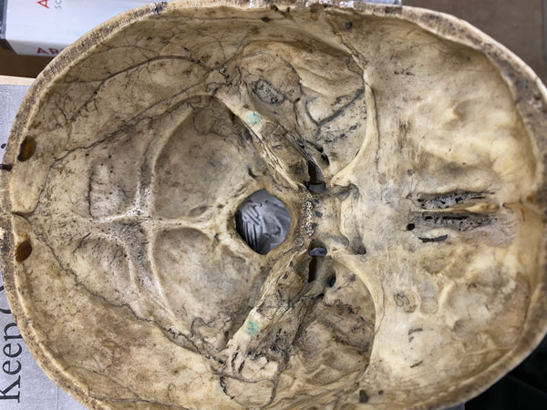 Antique 19th Century Medical Human Skull Teaching Aid - Source Vintage