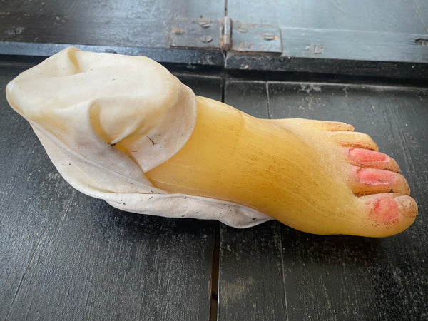 **RESERVED** Rare Antique Wax Medical Moulage Foot Study With Frostbitten Toes c.1900