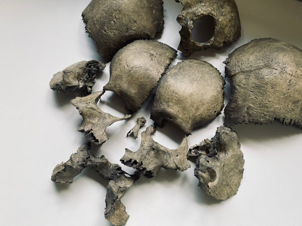 Rare Antique Victorian Medical Teaching Aid Exploded Human Skull In Period Box - Source Vintage