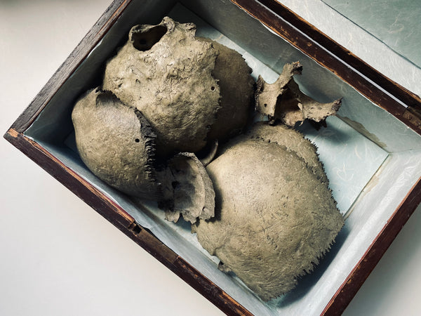 Rare Antique Victorian Medical Teaching Aid Exploded Human Skull In Period Box - Source Vintage
