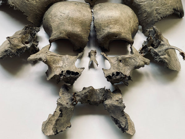 Rare Antique Victorian Medical Teaching Aid Exploded Human Skull In Period Box - Source Vintage