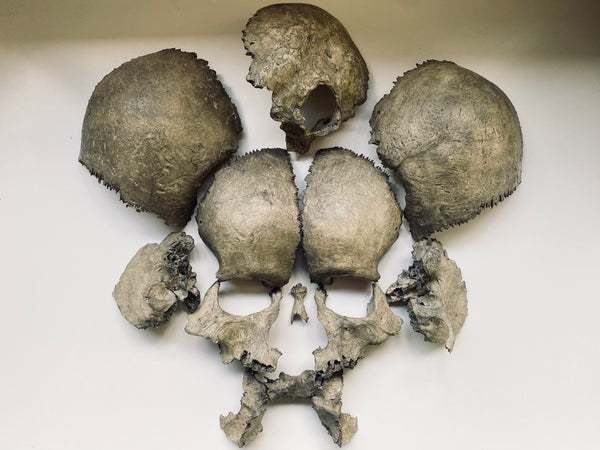 Rare Antique Victorian Medical Teaching Aid Exploded Human Skull In Period Box - Source Vintage