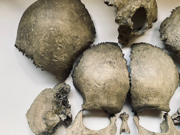 Rare Antique Victorian Medical Teaching Aid Exploded Human Skull In Period Box - Source Vintage