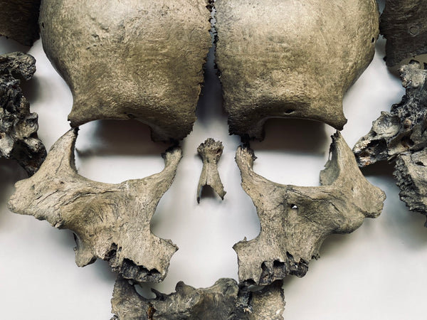 Rare Antique Victorian Medical Teaching Aid Exploded Human Skull In Period Box - Source Vintage