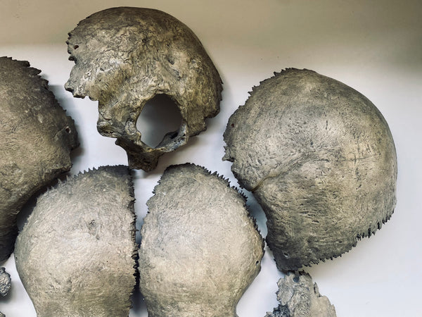 Rare Antique Victorian Medical Teaching Aid Exploded Human Skull In Period Box - Source Vintage