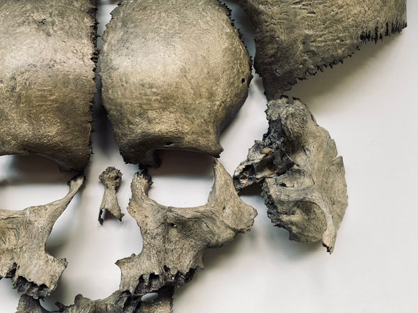 Rare Antique Victorian Medical Teaching Aid Exploded Human Skull In Period Box - Source Vintage