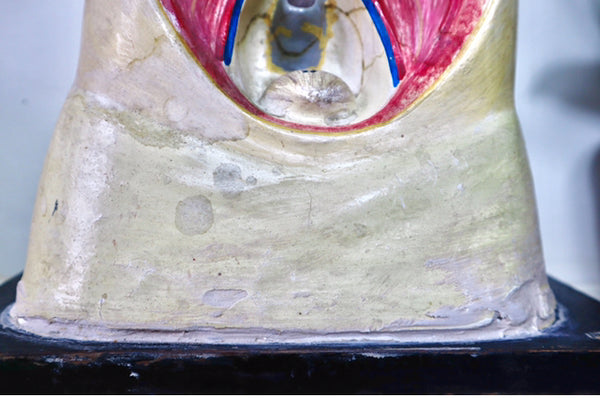 Rare Antique Vintage 1930s Handpainted Plaster Anatomical Bust Teaching Aid A/F - Source Vintage